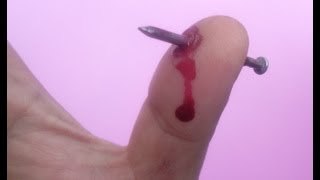 Broma genial - Dedo con clavo